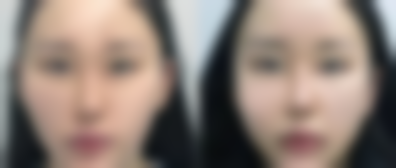 五、柳燕怎么预约？