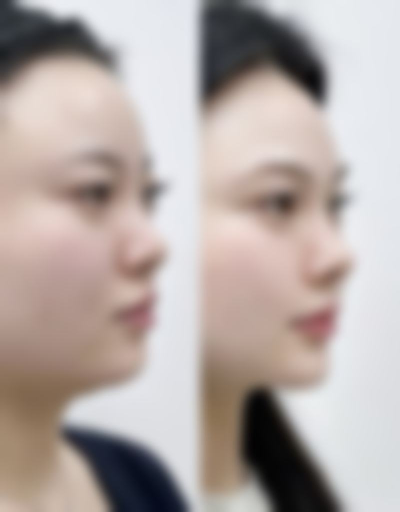 三、黄履攸技术优势