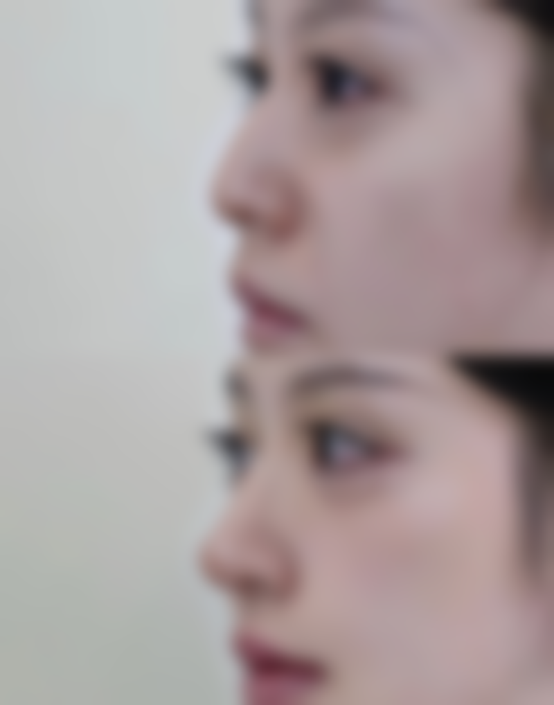 七、杭州芒塔玖橙整形医院预约方式