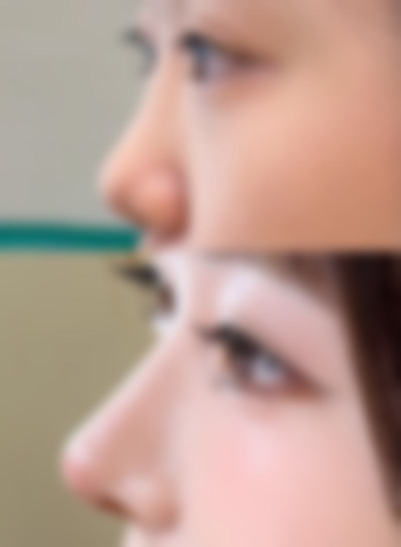 三、佛山君美整形医院诊疗项目有哪些?