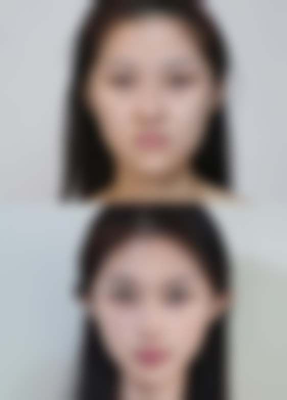 四、不同类型疤痕的科学处理建议