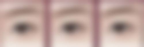 四、广州美瑞儿医疗美容门诊部特色项目