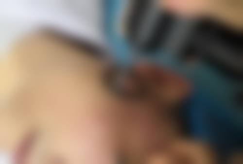 怎么才能让双眼皮明显一点？非手术与医美方案助你打造清晰自然双眼皮