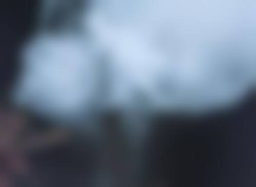 六、怎样消除手烫伤疤痕之手术治疗手段