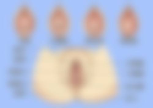 怎样消除手烫伤疤痕？从日常护理到医美手术多方法助你淡化疤痕恢复手部美观