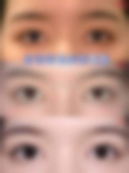 九、无锡可琳雅整形医院真实的患者评价