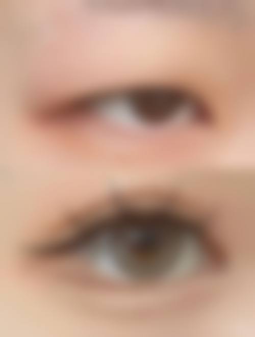 四、池州悦美整形医院特色项目