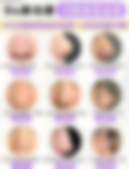 四、郴州维纳斯整形特色项目