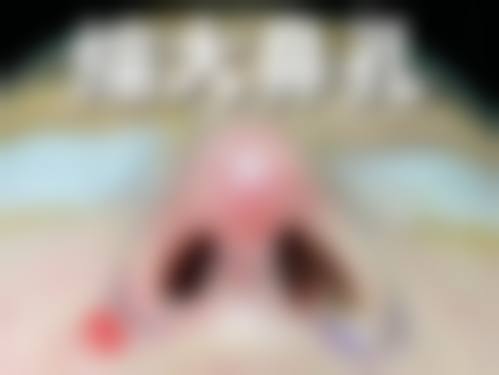 五、沈阳天使医疗美容诊所价格表