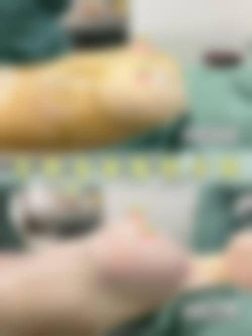 八、韩国德莱茵TheLine整形外科真实的患者评价