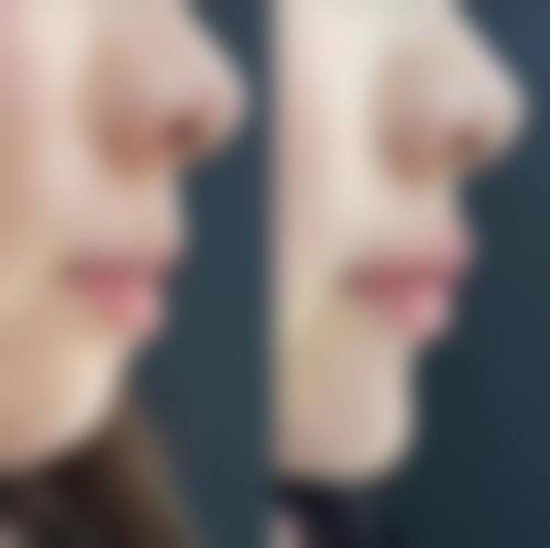 四、郑州爱美丽整形医院特色项目