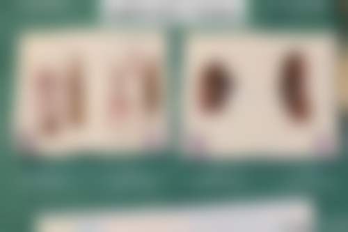 六、无锡可琳雅整形医院价格表