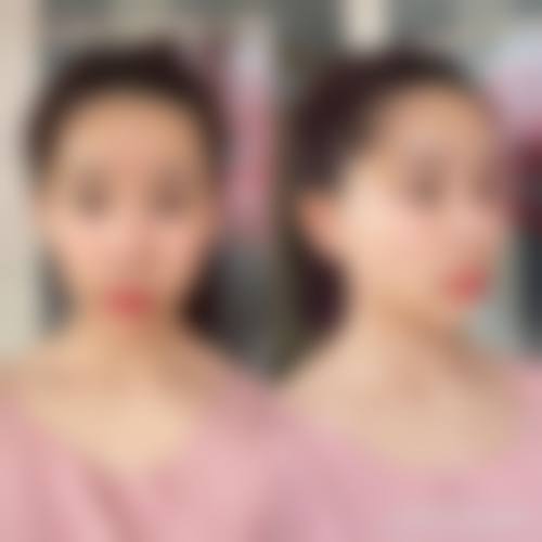 五、池州悦美整形医院价格表