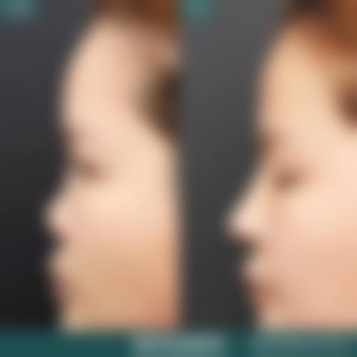 八、台湾妮蔻时尚诊所真实的患者评价