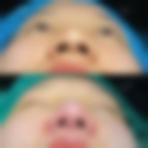 九、惠州瑞禧医疗美容诊所真实的患者评价