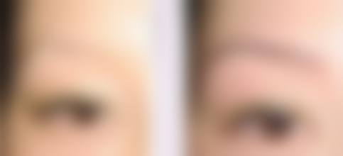 八、厦门华美医学美容医院预约方式