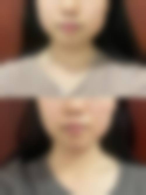 五、郑州爱美丽整形医院价格表