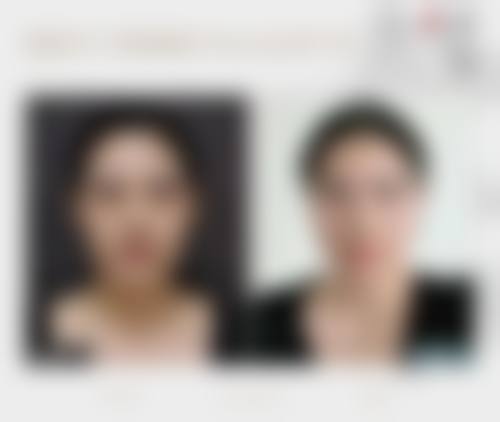 七、佛山星面孔科伊特整形医院预约方式