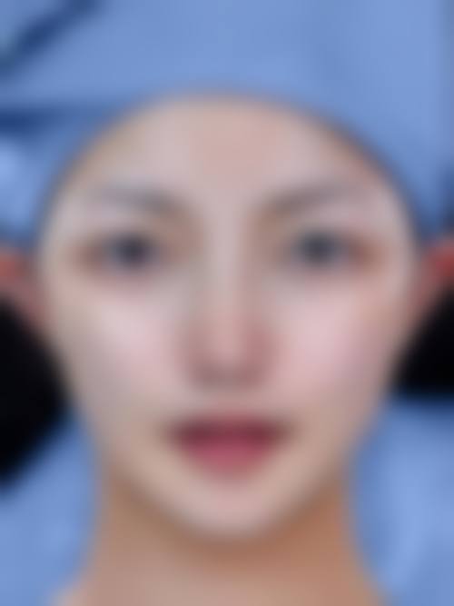 八、池州悦美整形医院真实的患者评价