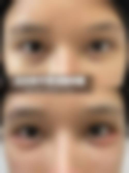 七、成都高新轻美时光整形医院预约方式