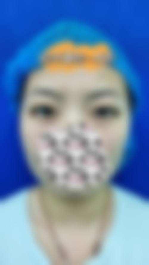 二、佛山星面孔科伊特整形医院怎么样?