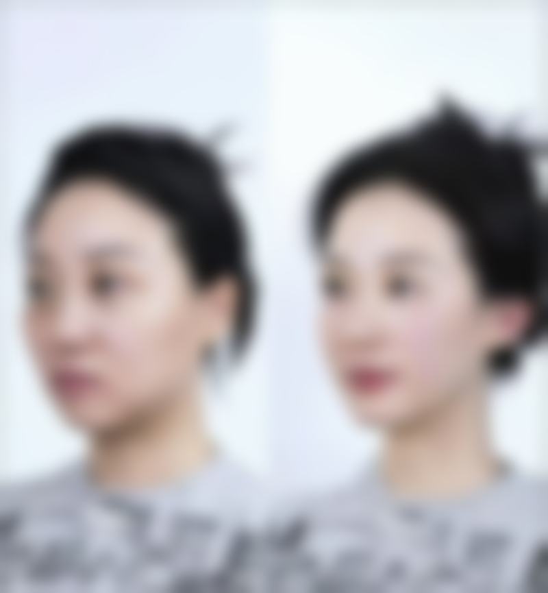 八、珠海缤丽医疗美容诊所真实的患者评价