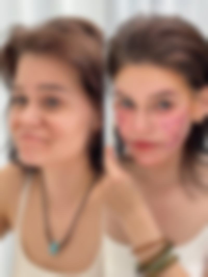 三、内江韩美医疗美容整形门诊部诊疗项目有哪些？