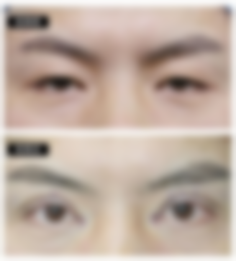 八、苏州美丽港湾整形医疗美容医院真实的患者评价