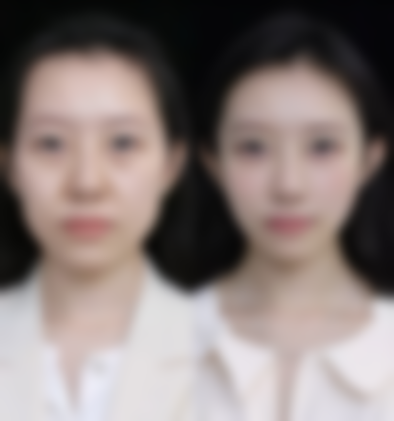 九、七台河市人民医院手足整形美容烧伤外科真实的患者评价