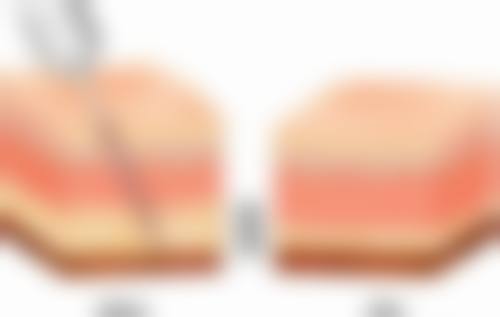 八、江门市皮肤病医院整形美容科预约方式