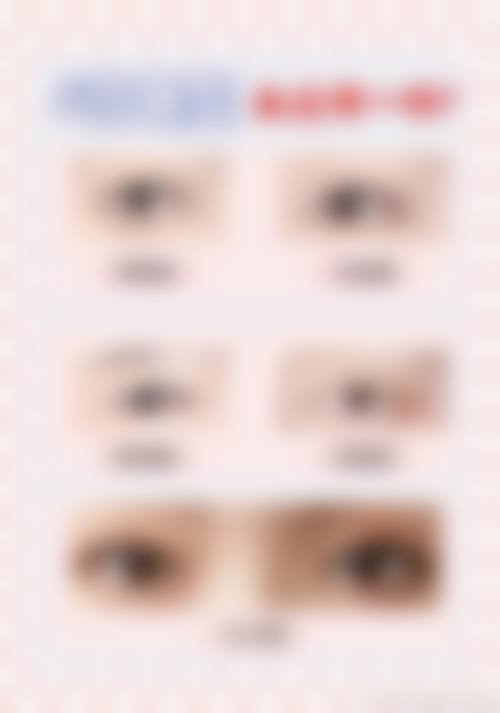 八、青岛亚美妍医疗美容门诊部真实的患者评价