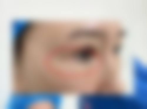 三、山东第一医 科 大学附属皮肤病医院(激光美容外科)诊疗项目有哪些?