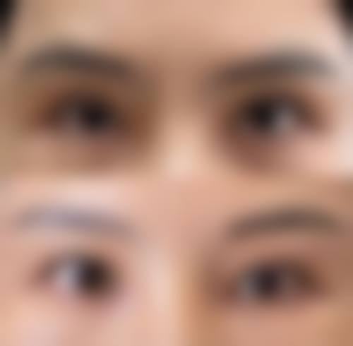 五、西安同仁医院价格表