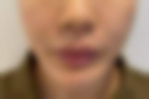 二、韩国ROCOCO整形外科怎么样?