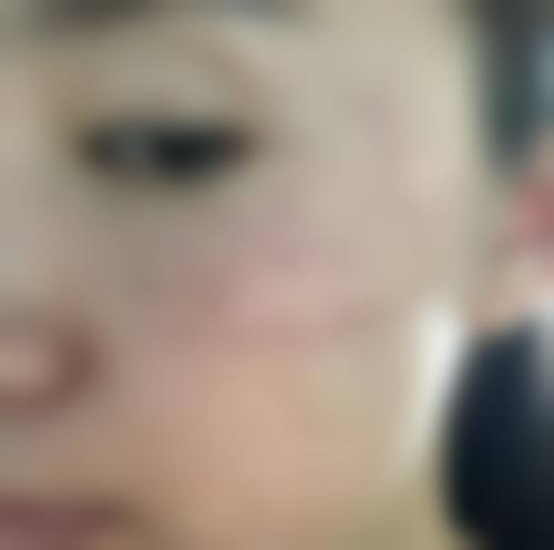 五、惠州市中 心人民医院烧伤整形手足外科价格表