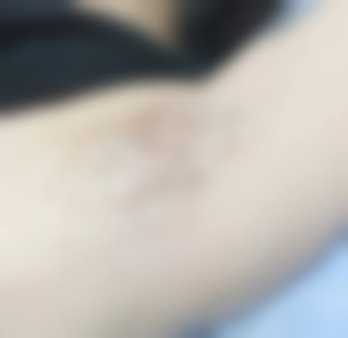 九、哈尔滨市南岗区医仁美医疗美容门诊部真实的患者评价