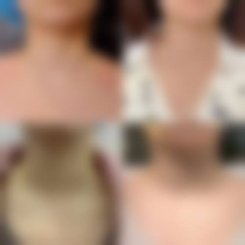 八、北京贝丽芙医疗美容诊所真实的患者评价