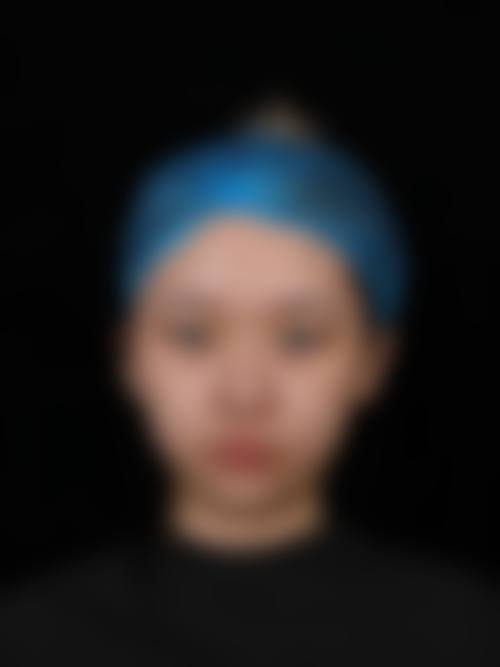 九、湘潭华美美容真实的患者评价