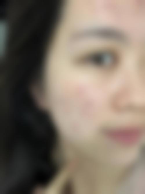 九、广州慕美医疗美容门诊部真实的患者评价