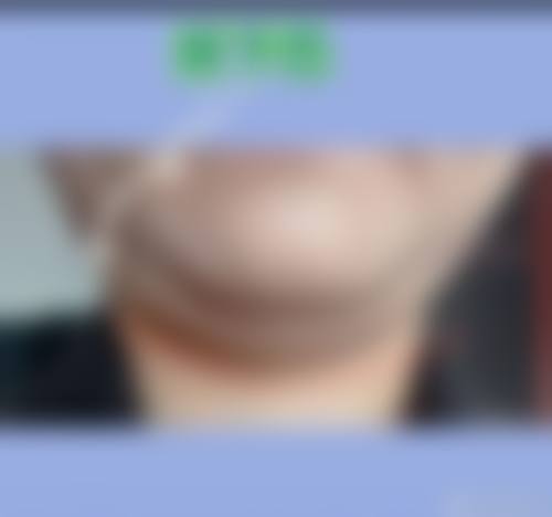 四、乌海贝芙丽医疗美容诊所特色项目