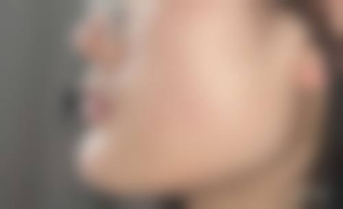 九、江门市皮肤病医院整形美容科真实的患者评价