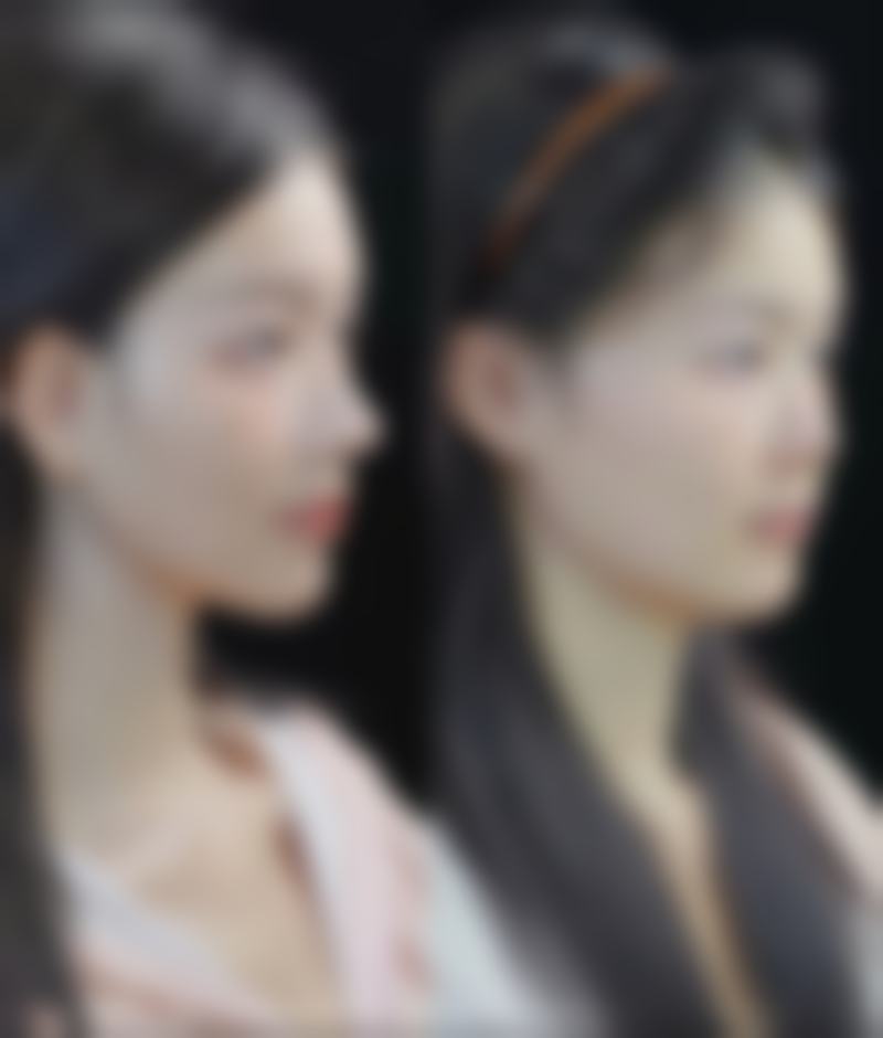 三、韩国ROCOCO整形外科诊疗项目有哪些?