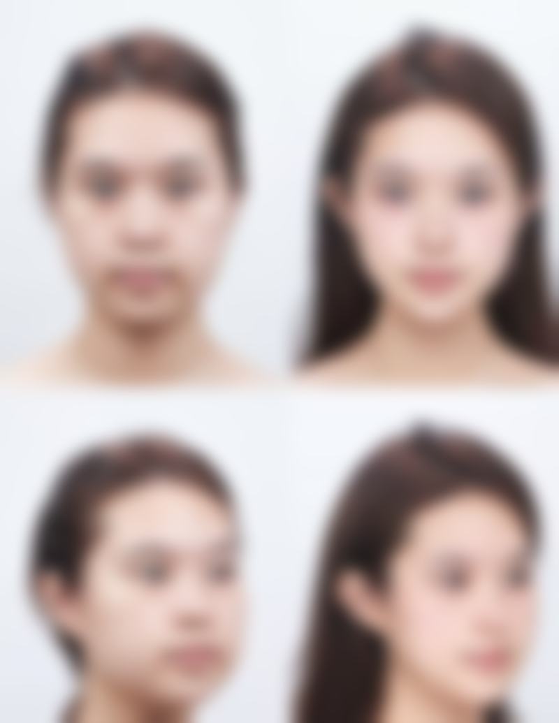 四、青岛致美尚美美容诊所特色项目