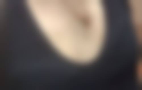 六、甲亢手术疤痕去除的方法