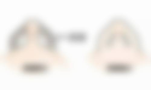 四、疤痕处红肿的物理保护措施