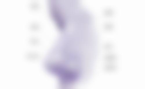 一、外切导致凹陷可以修复吗眼袋：术后凹陷的常见原因及修复可能性