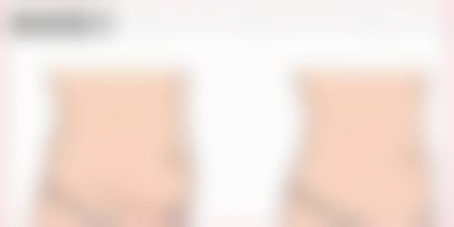 三、不同医生对切眼袋时间的影响