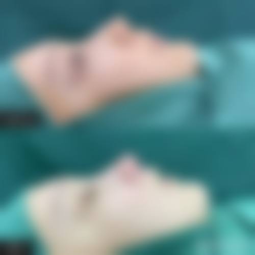 九、成都景华医疗美容门诊部真实的患者评价