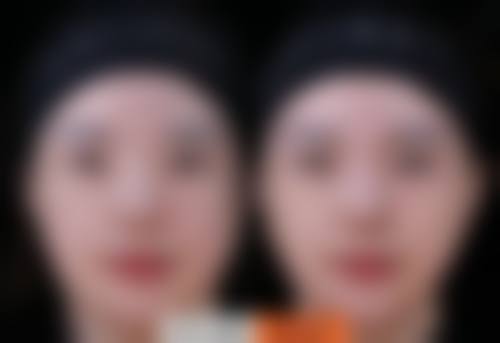 四、大连维恩柏颜整形医院特色项目