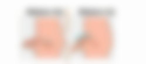 六、乐威真实的患者评价